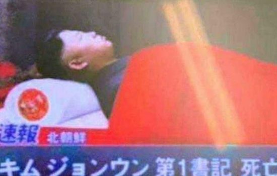 Foto Diduga Jasad Kim Jong Un Beredar di Medsos, Hastag #Kimjongundead Trending